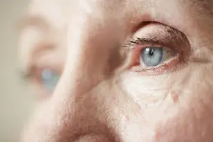 Degeneración macular en los ojos